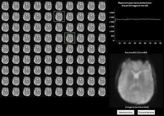 fMRI source images