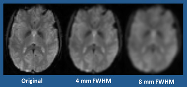 spatial smoothing fMRI