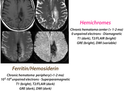 chronic hematoma appearance